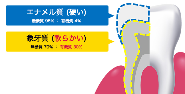 エナメル質 (硬い) 無機質 96% : 有機質 4% 象牙質 (軟らかい) 無機質 70% : 有機質 30%