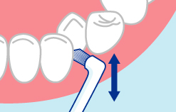歯並びが悪い箇所の磨き方