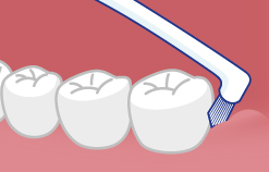 奥歯の奥の磨き方