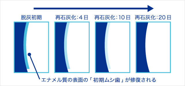・エナメル質の表面の「初期ムシ歯」が修復される イメージ図