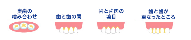 奥歯の噛み合わせ 歯と歯の間 歯と歯肉の境目 歯と歯が重なったところ