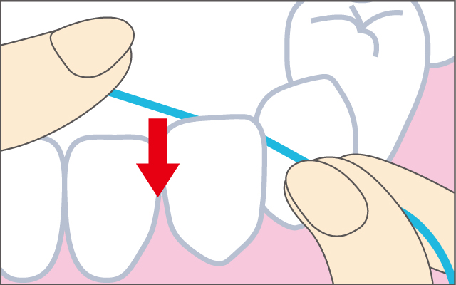 歯と歯の間に、小さく動かしながら、ゆっくり入れる。